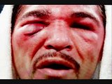 Watch Antonio Margarito vs Manny Pacquiao FIGHT VIDEO!!!