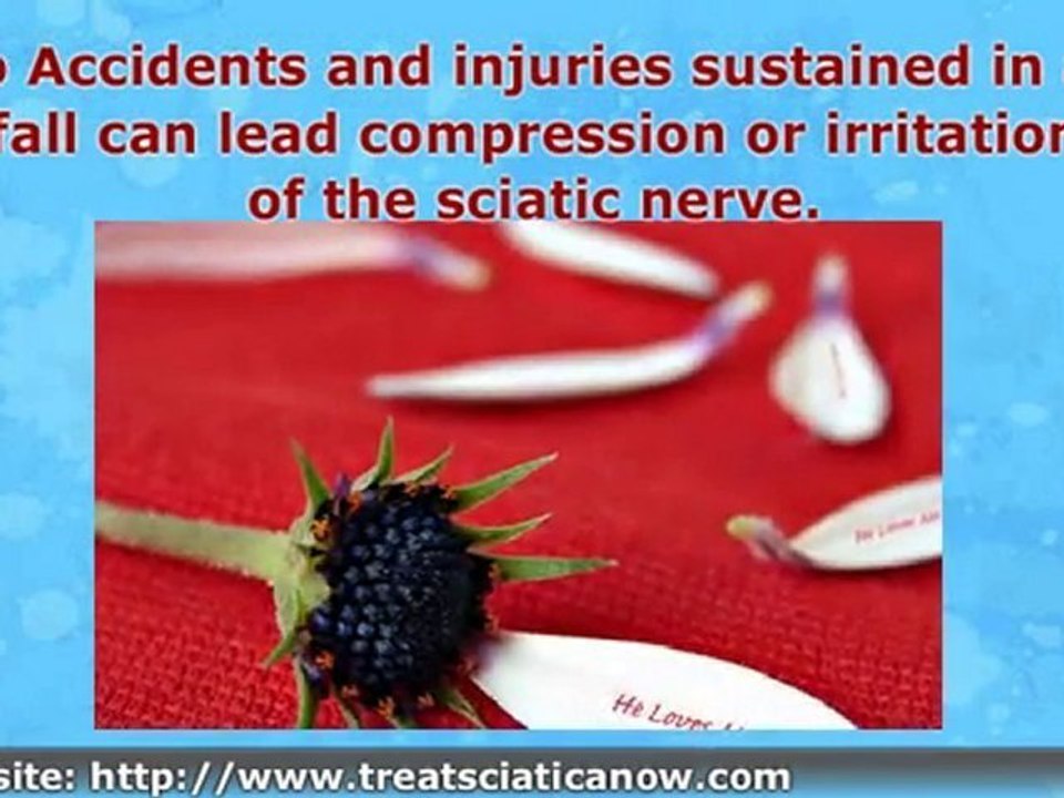 Sciatica Causes and Risk Factors