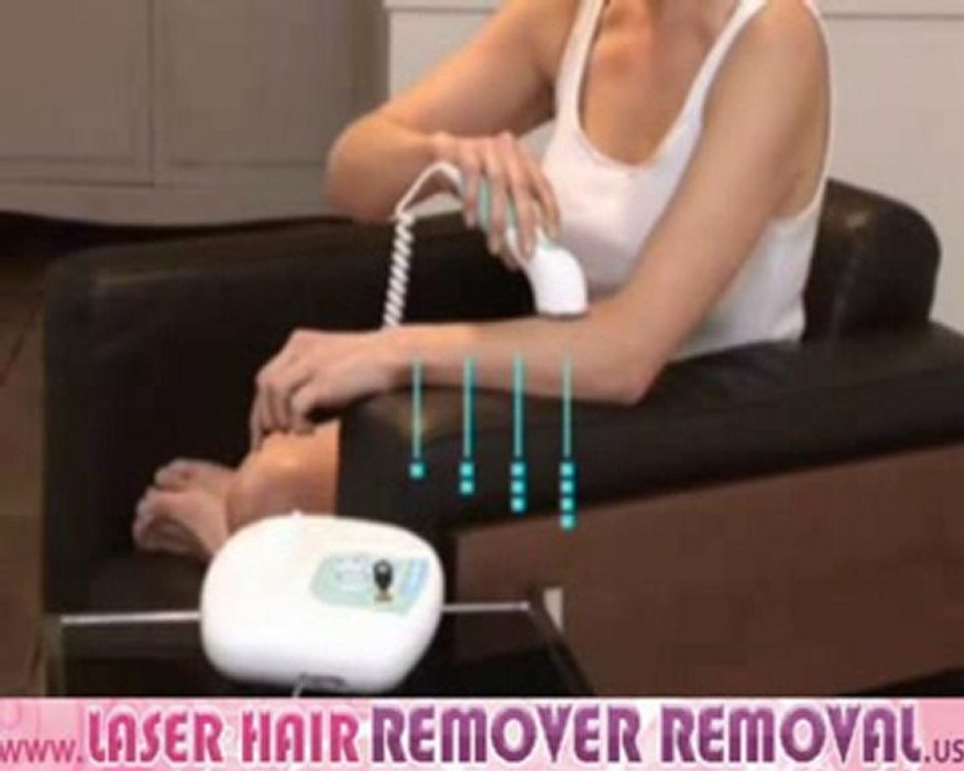 Permanent laser hair removal, Rio Scanning Laser 1/2 - video Dailymotion