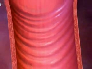 Yeast Infection Home Remedy  -  "SECRET"