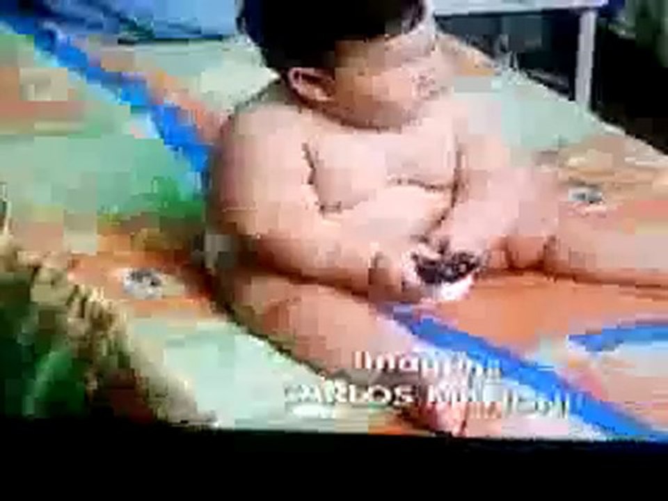MDR