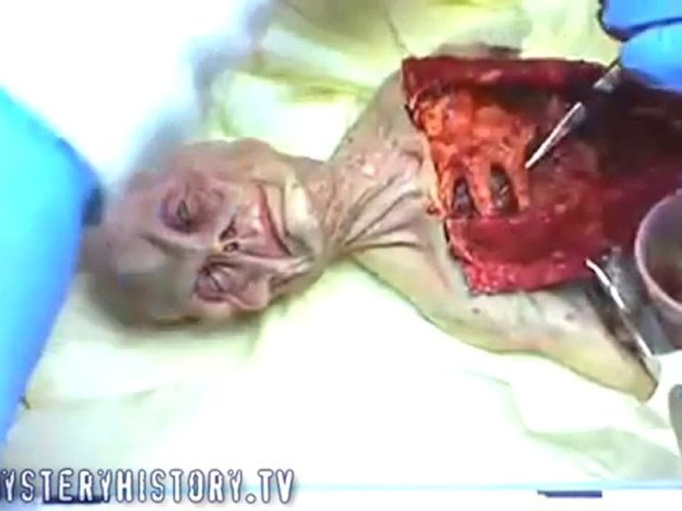 Alien Autopsy : Surfaced Online 2008 Location Unknown