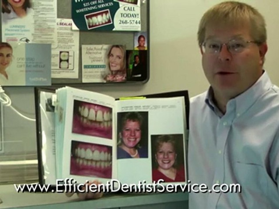 Porcelain veneers, veneers, lumineers in Columbus Ohio 4321