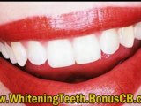 Whitening Teeth With Braces - Whitening Teeth Naturally