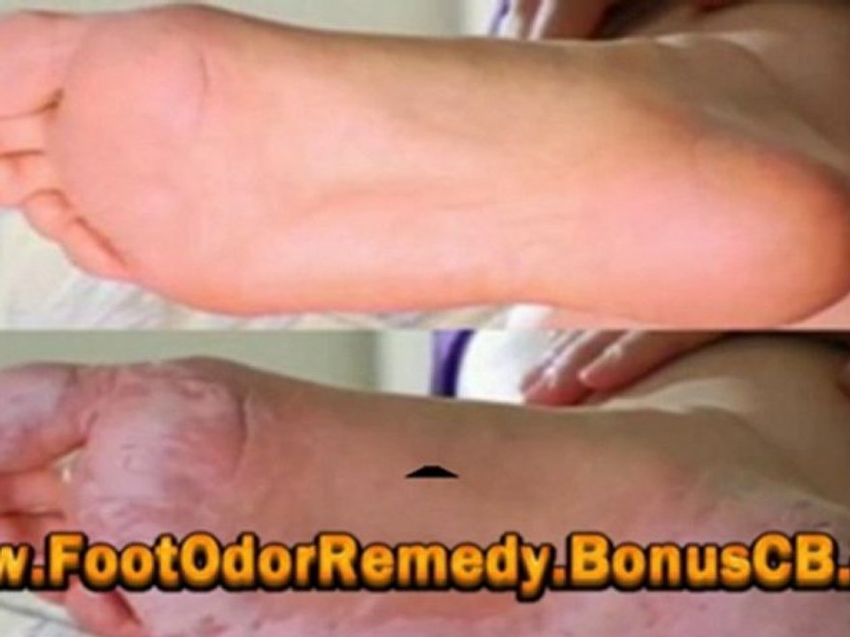 Male Foot Odor - Woman Foot Odor - How To Cure Foot Odor