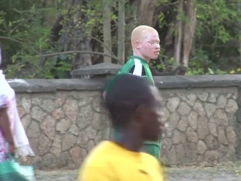 Albinos unite through football