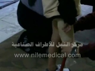 2مركز النيل للاطراف الصناعية والمستلزمات الطبية