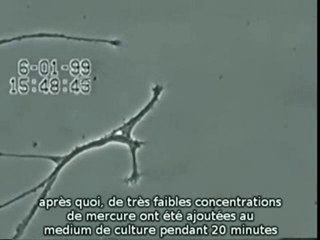 SANTE : effets du mercure sur les neurones.
