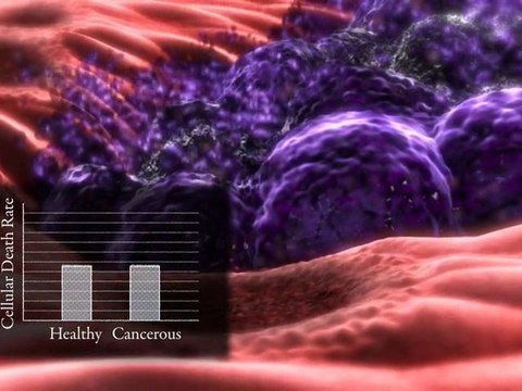 Nanomedicine: nanoparticles for cancer treatment