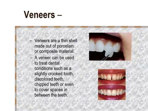 Temecula Cosmetic Dentistry Presents How Cosmetic Dentistry