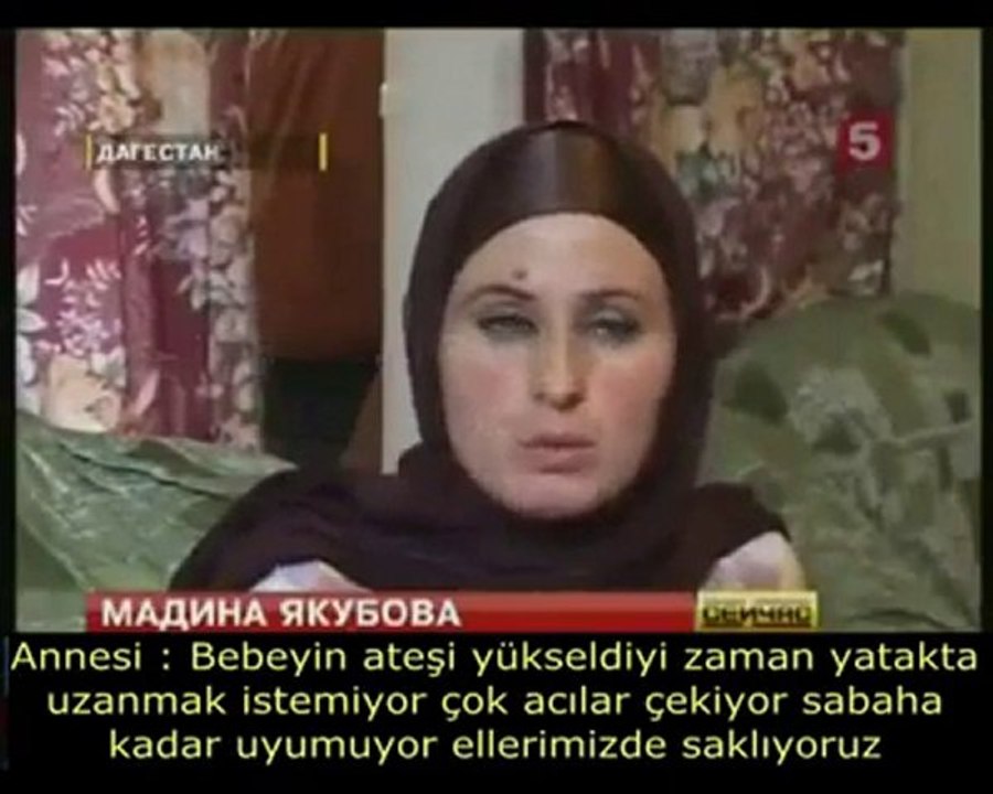 ALLAH c.c BİR MUCİZESİDİR BU...!!! (mutlaka izle)