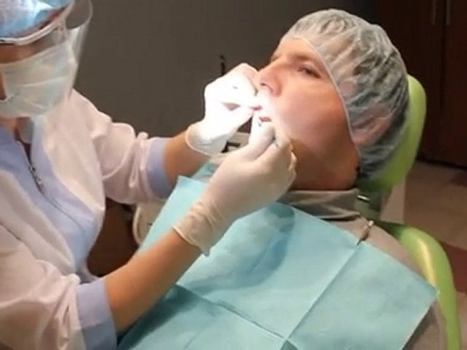 Москва: Скидка 55% на реставрацию зубов