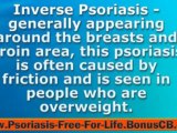 Nail Psoriasis Home Remedies - Psoriasis Cures Natural
