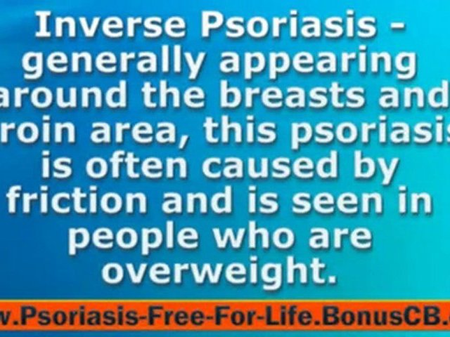 Psoriasis Hands Treatment – Psoriasis Herbal Treatment