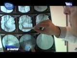 Artérite : dépistage gratuit à l'hôpital de Pontoise