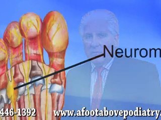 Sports Medicine - Podiatrist in Havertown, PA