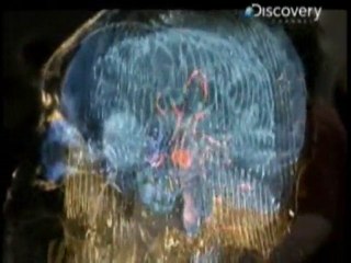 Hipotalamo: El fracaso de las dietas