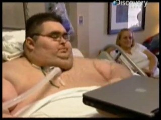 Obesidad morbida: El luchador de sumo
