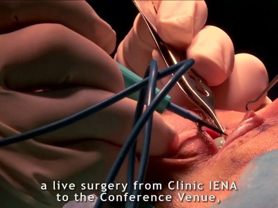 IMCAS
