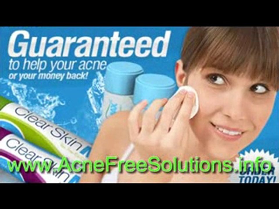 Acne Treatment