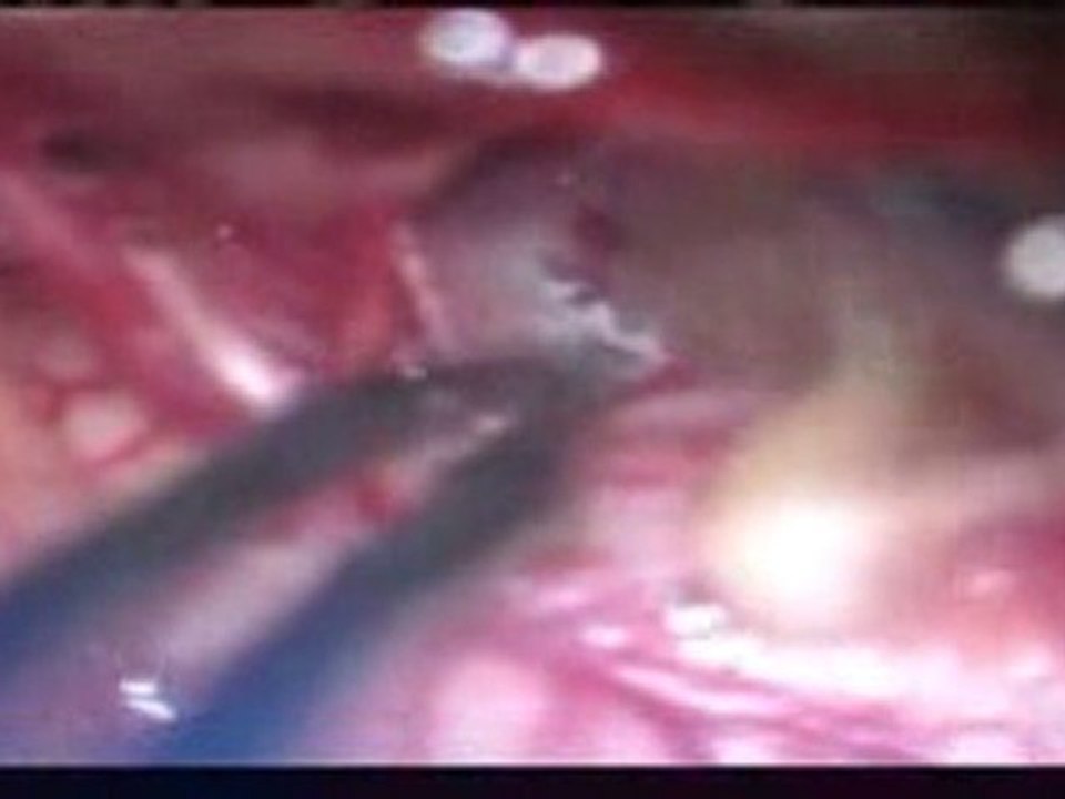 PORK MAKES WORMS GROW IN YOUR BRAIN!!
