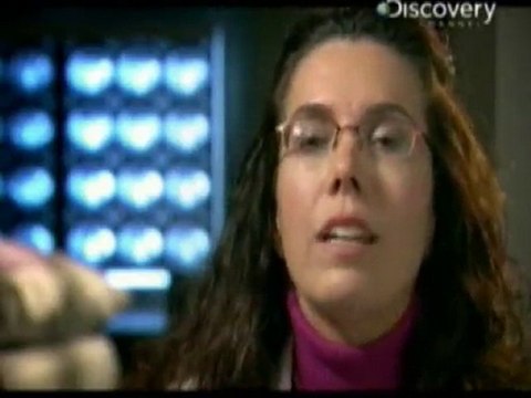 Obesidad morbida: Cirugia bariatrica