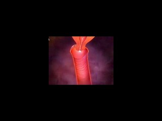 Looking for Yeast Infection Cure | Yeast Infection Treatment