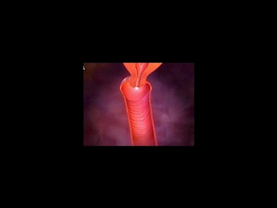 Looking for Yeast Infection Cure | Yeast Infection Treatment