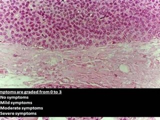 Effective Thyroid Function Testing - Thyroidflex