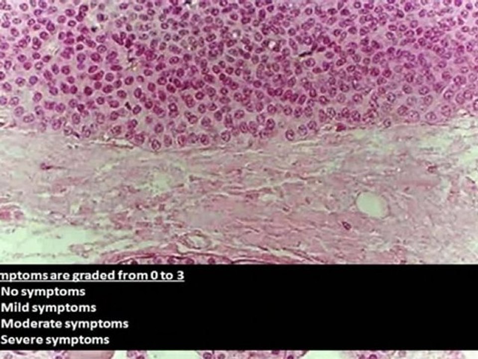 Effective Thyroid Function Testing - Thyroidflex