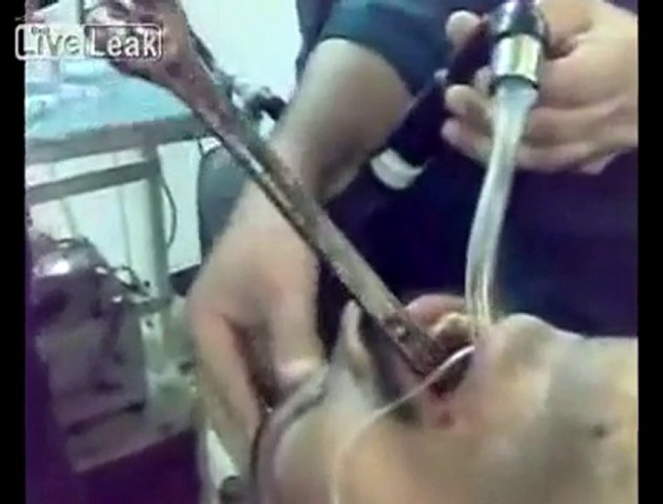 anahtar yutan adam