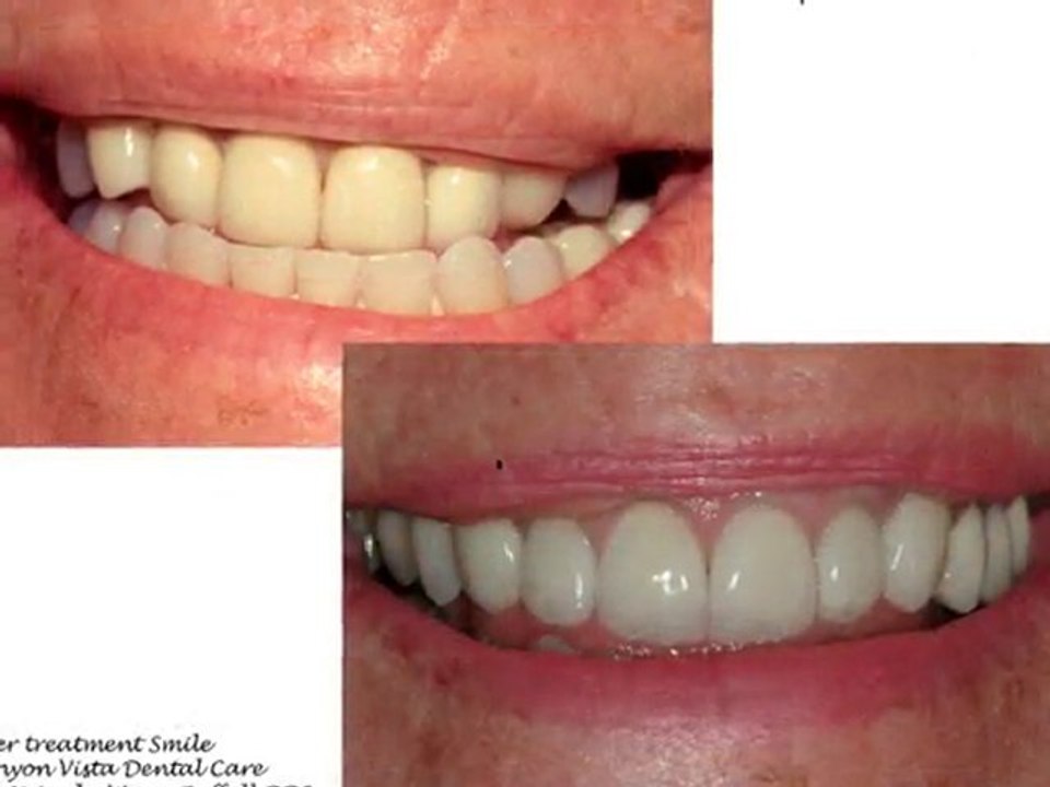 Apache Junction Cosmetic Dentist & Orthodontist