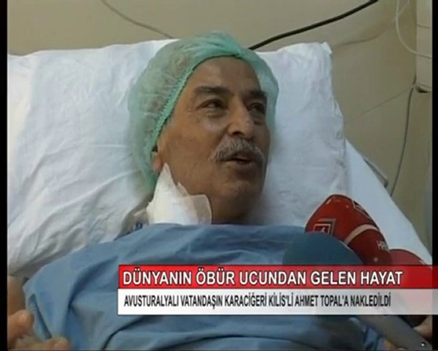 4-ORGAN NAKLİ
