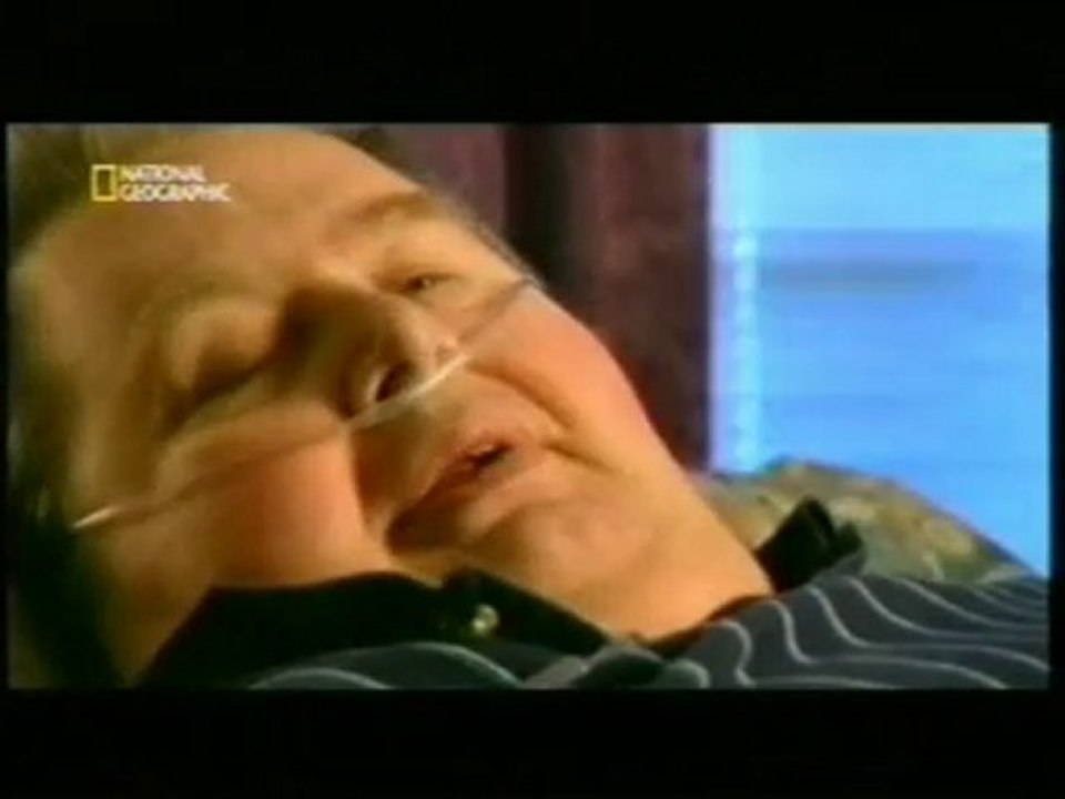 Alan: Obesidad morbida (Globesidad)