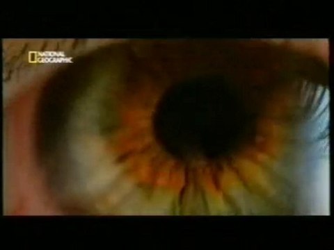 LSD y cerebro: Estados psicoticos (un mal viaje)