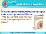 How to Get Rid of Tonsil Stones Naturally?