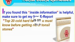 What foods should I avoid in order to prevent tonsil stones
