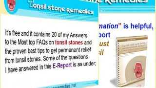 What Doctor should I see for tonsil stones?