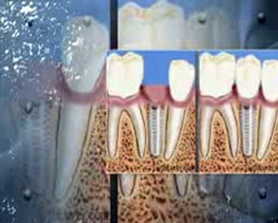 Dentiste Montreal