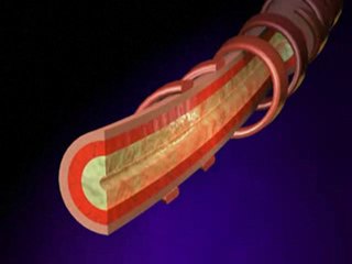 What is Asthma: Chronics Asthma Facts