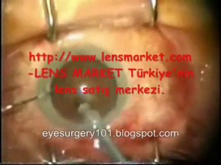 Lens Satış Merkezi - Lensmarket.com