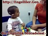 Minik Engellinin Sese Verdiği İlk Tepki Engelliler.Gen.tr