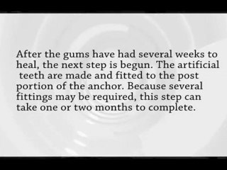 Teeth That Go Bling With Arvada Dentist