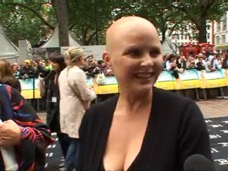 Gail Porter uses stickers to cover her alopecia