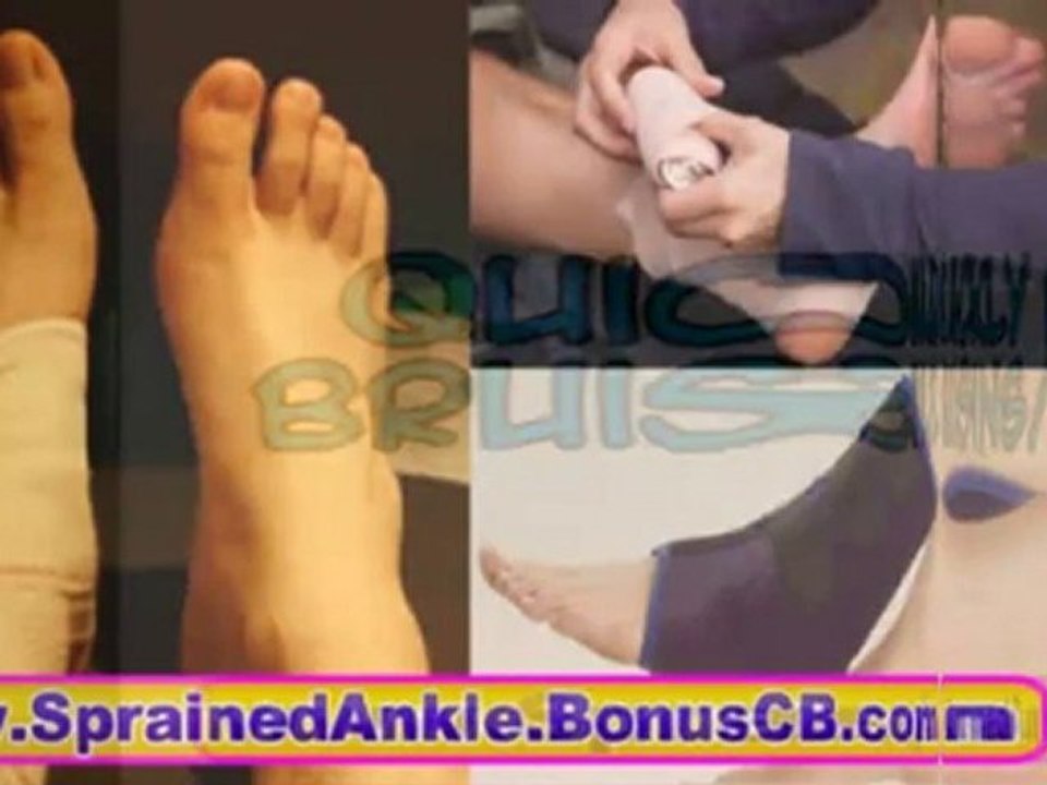 Shin Splints ankle pain sports injuries self treatment
