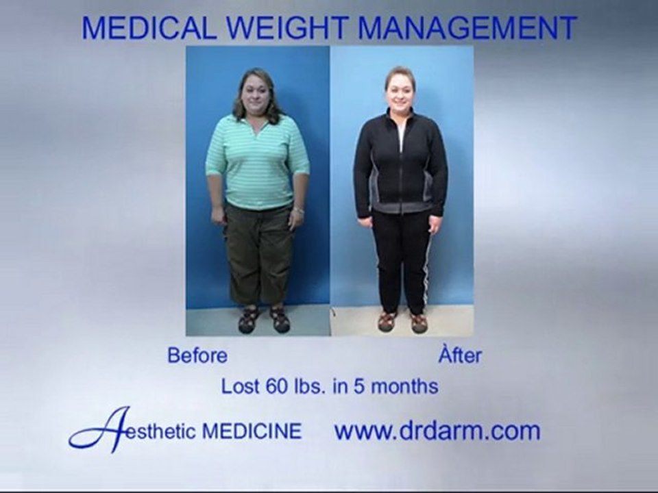 Before and After - Wrinkles Medical Weight Management