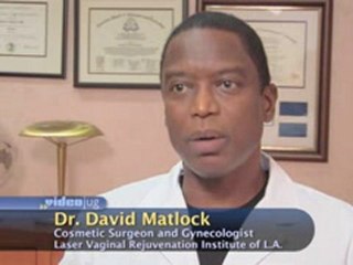 Labiaplasty : Do large labias restrict physical movement?