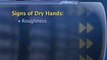 Care For Dry And Aging Hands : How can I prevent dry skin on my hands?