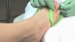 Pedicure Basics : What are 'toe separators'?