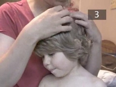 How To Get Rid Of Nits